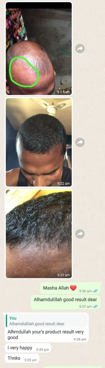 Customer WhatsApp result screenshot with hair progress