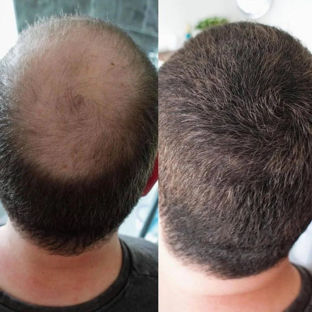 Customer before and after hair result